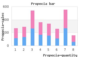 cheap propecia 1mg amex