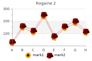 cheap 60 ml rogaine 2 with visa